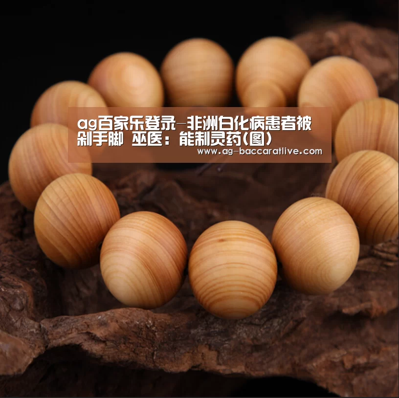 ag百家乐登录-非洲白化病患者被剁手脚 巫医:能制灵药(图)(图3) ag百家乐官方